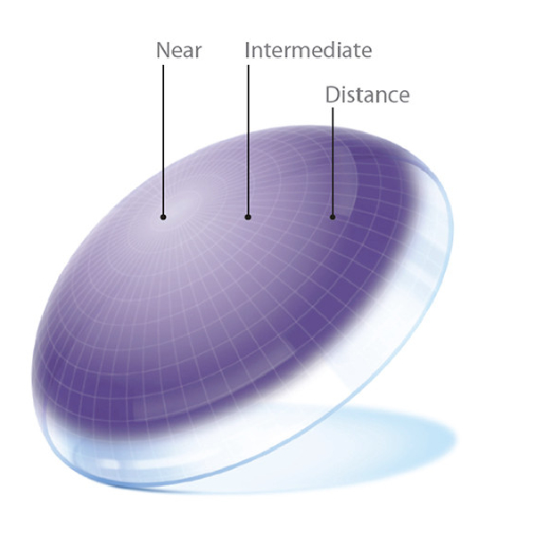 Anizham Optics+Multifocals Lenses